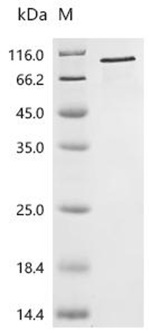 Recombinant Human Gelsolin (GSN) (CSB-EP009965HUc7) Recombinant Human Gelsolin (GSN) (CSB-EP009965HUc7)