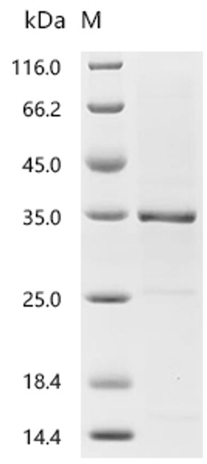 Recombinant Mouse Granzyme A (Gzma) (CSB-EP010081MOc7) Recombinant Mouse Granzyme A (Gzma) (CSB-EP010081MOc7)