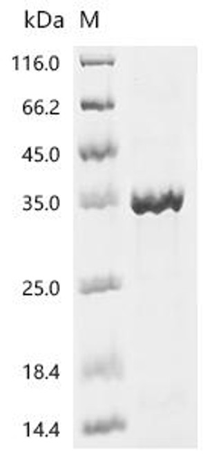 Recombinant Human Orexin receptor type 2 (HCRTR2), partial (CSB-EP010232HU1) Recombinant Human Orexin receptor type 2 (HCRTR2), partial (CSB-EP010232HU1)