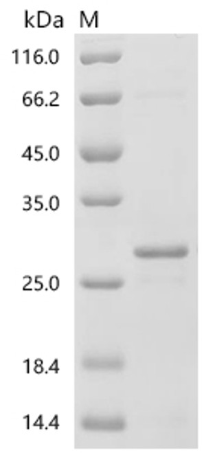 Recombinant Human Interleukin-10 (IL10) (CSB-EP011580HUa0)