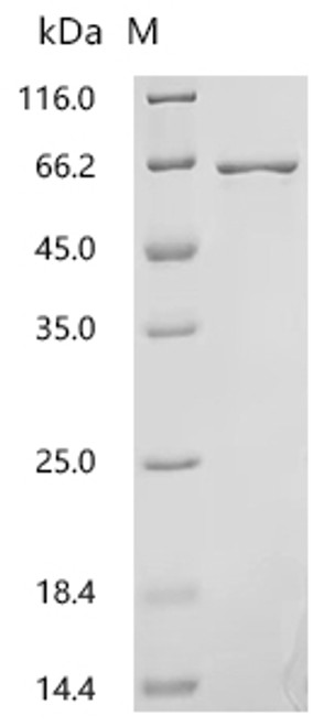 Recombinant Human L-amino-acid oxidase (IL4I1), partial (CSB-EP850426HU1g5)