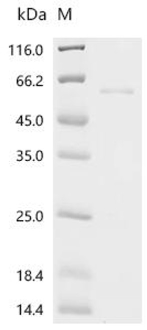 Recombinant Mouse Interferon regulatory factor 9 (Irf9) (CSB-EP011824MO)