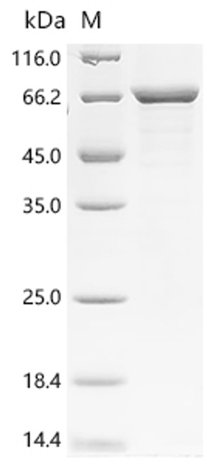Recombinant Human Keratin, type II cytoskeletal 2 epidermal (KRT2) (CSB-EP012535HUc7)