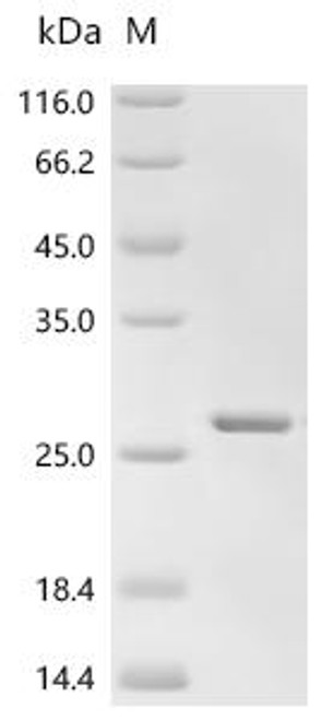 Recombinant Human Galectin-9 (LGALS9), partial (CSB-EP012895HU2)