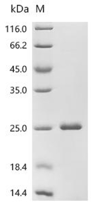 Recombinant Human Galectin-9 (LGALS9), partial (CSB-EP012895HU2a0)