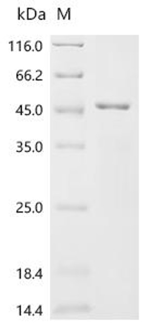 Recombinant Pseudomonas aeruginosa LPS-assembly protein lptD (lptD), partial (CSB-EP492739EZY)