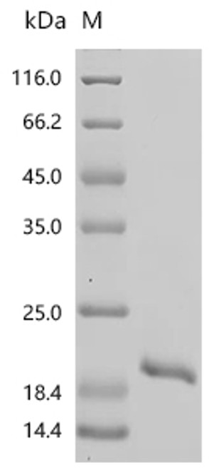 Recombinant Human MAP kinase-activating death domain protein (MADD), partial (CSB-EP819910HU)
