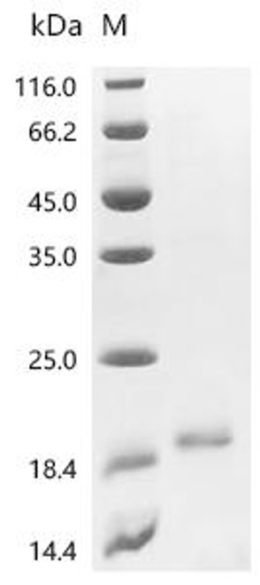 Recombinant Fusarium oxysporum f. sp. lycopersici ribonuclease T1 (CSB-EP6416FFP)