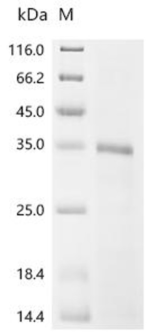 Recombinant Piscinibacter sakaiensis Poly(ethylene terephthalate) hydrolase, partial (CSB-EP2729GQM)
