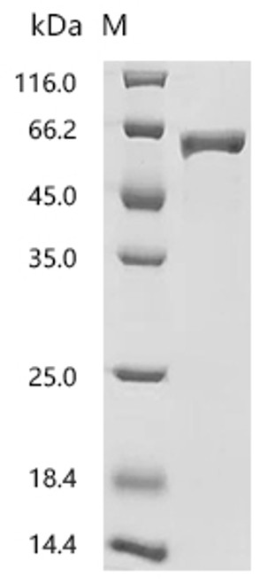 Recombinant Human Nucleosome assembly protein 1-like 1 (NAP1L1) (CSB-EP015441HU)