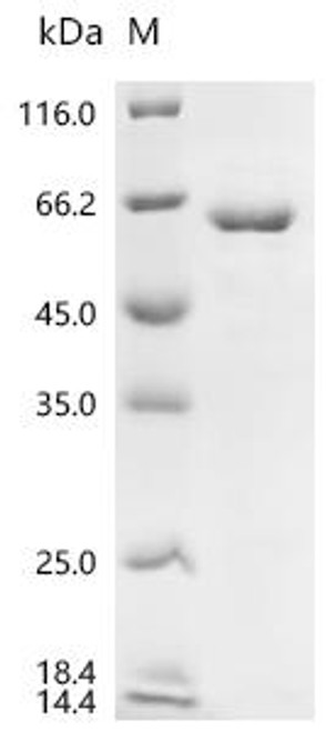 Recombinant Human RNA-binding protein Nova-1 (NOVA1) (CSB-EP015957HU)