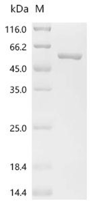 Recombinant avian paramyxovirus 4 Nucleocapsid (NP) (CSB-EP6450)