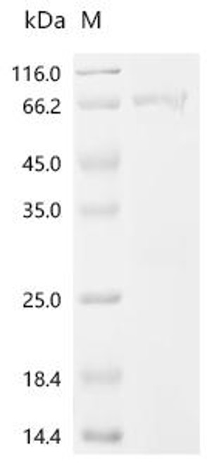 Recombinant Mouse Pituitary homeobox 3 (Pitx3) (CSB-EP018044MOf0)