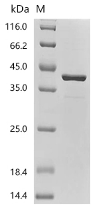 Recombinant Human Polymerase delta-interacting protein 2 (POLDIP2) (CSB-EP896496HU)
