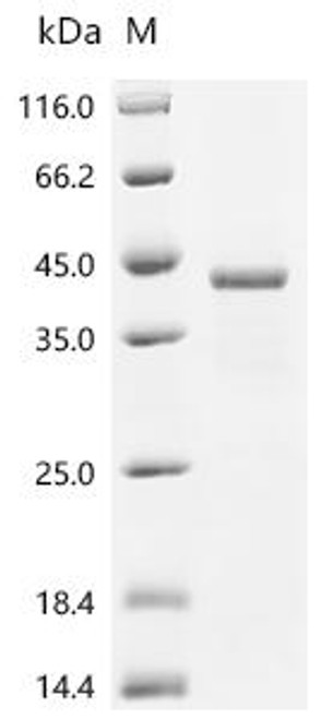 Recombinant Human cAMP-dependent protein kinase catalytic subunit alpha (PRKACA) (CSB-EP018688HUe2)