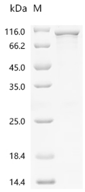 Recombinant Human Protein kinase C gamma type (PRKCG) (CSB-EP018705HU)
