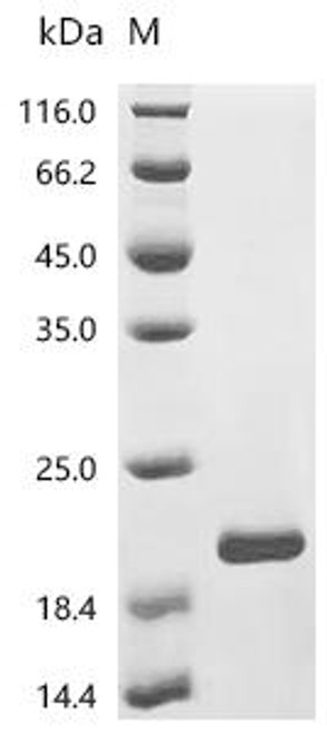 Recombinant Bordetella pertussis Pertactin autotransporter (prn), partial (CSB-EP321224BUA2)