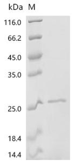 Recombinant Bordetella pertussis Pertactin autotransporter (prn), partial (CSB-EP321224BUA3)