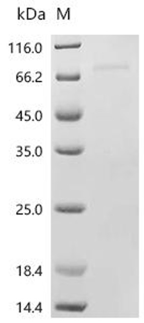 Recombinant Human Prostaglandin G/H synthase 1 (PTGS1) (CSB-EP018985HUc7)