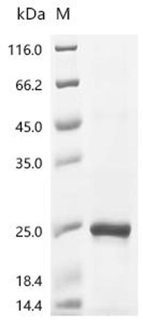 Recombinant Bovine Ribonuclease 4 (RNASE4) (CSB-EP019796BO)