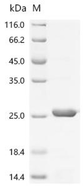 Recombinant Micrococcus luteus Large ribosomal subunit protein bL12 (rplL) (CSB-EP514550MTP)