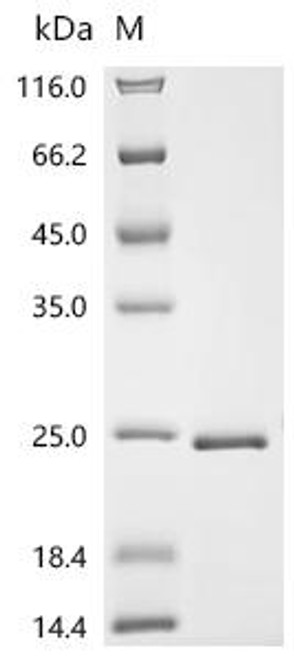 Recombinant Staphylococcus sp. EG-SA-26 Large ribosomal subunit protein uL22 (rplV) (CSB-EP6440GZV)