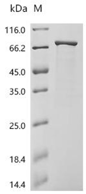 Recombinant Escherichia coli Small ribosomal subunit protein bS1 (rpsA) (CSB-EP314176ENV)