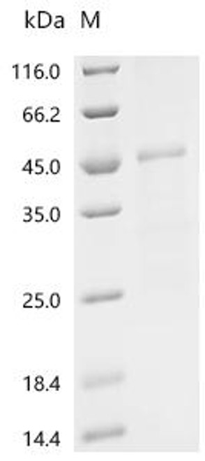 Recombinant Murine coronavirus Spike glycoprotein (S), partial (CSB-EP318118MJY)