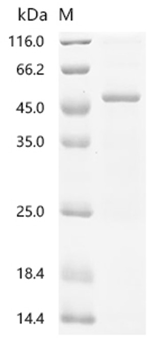Recombinant Human Serpin B5 (SERPINB5) (CSB-EP021073HU)