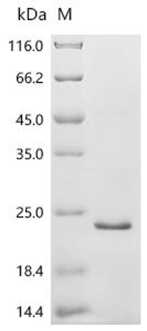 Recombinant Human Solute carrier family 22 member 4 (SLC22A4), partial (CSB-EP861980HU)