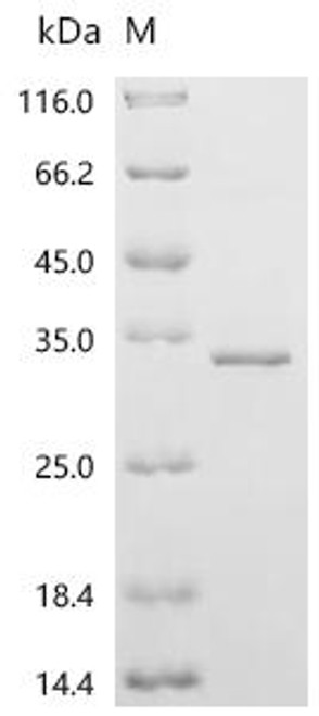 Recombinant Human StAR-related lipid transfer protein 6 (STARD6) (CSB-EP022805HU)