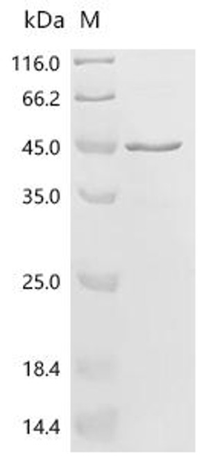 Recombinant Human Synemin (SYNM), partial (CSB-EP023019HU)