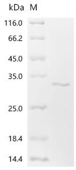 Recombinant Mouse TAF15 RNA polymerase II, TATA box binding protein (TBP)-associated factor (Taf15), partial (CSB-EP6308MO)