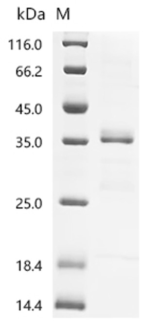 Recombinant Mouse Transforming growth factor beta-1 proprotein (Tgfb1), partial (CSB-EP023446MOe0)