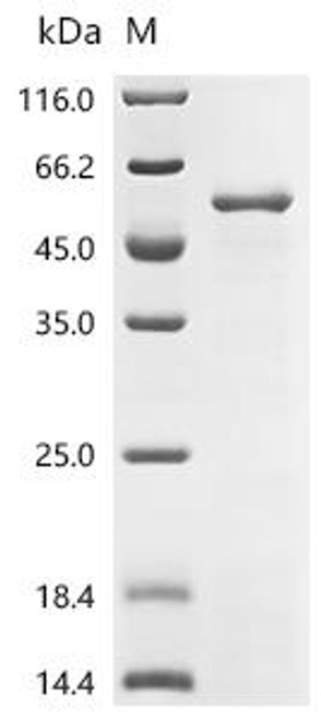 Recombinant Staphylococcus aureus Elongation factor Tu (tuf) (CSB-EP025342SKY)