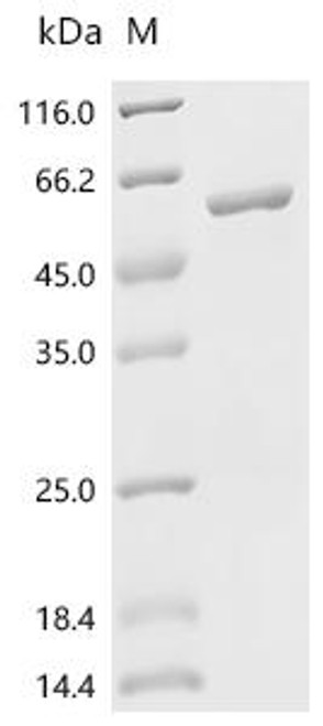 Recombinant Human UDP-glucuronosyltransferase 1A4 (UGT1A4), partial (CSB-EP025577HU1)