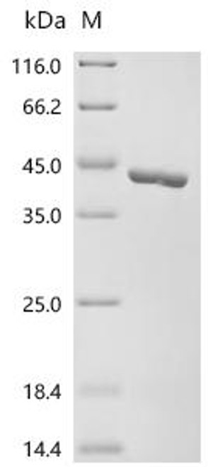 Recombinant Macaca fascicularis Uricase (UOX) (CSB-EP822639MOV)