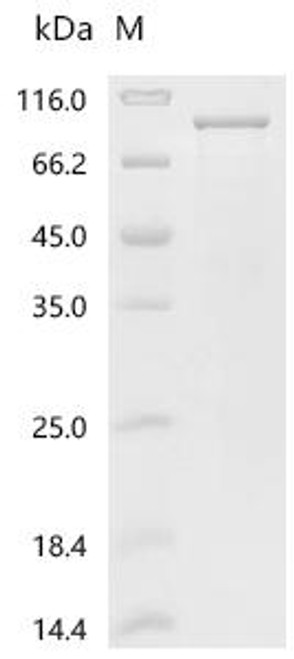 Recombinant Helicobacter pylori Vacuolating cytotoxin autotransporter (vacA), partial (CSB-EP675247HUS1)