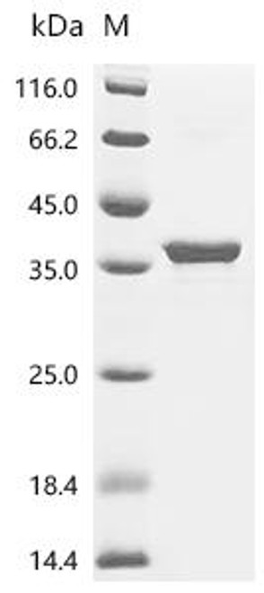Recombinant Escherichia coli Sugar phosphatase YidA (yidA) (CSB-EP364244ENV)