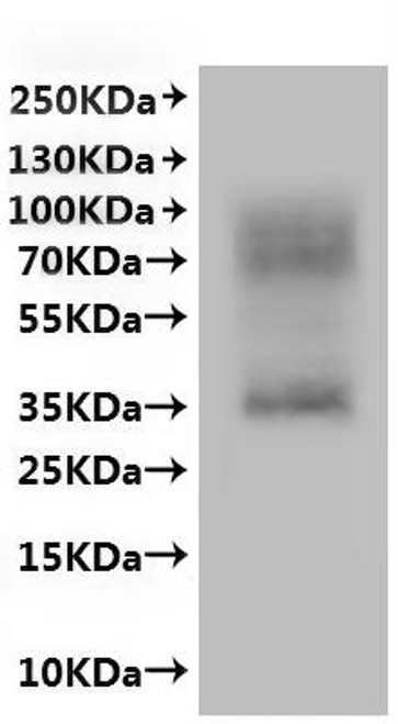 Recombinant Human P2Y purinoceptor 8 (P2RY8)-VLPs (CSB-MP773043HU)