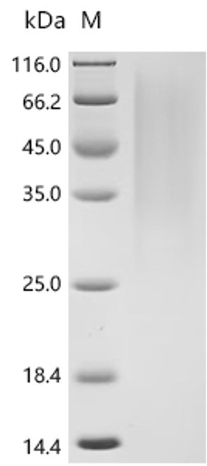 Recombinant Mouse Glucagon-like peptide 1 receptor(Glp1r), partial (CSB-YP009514MO1)