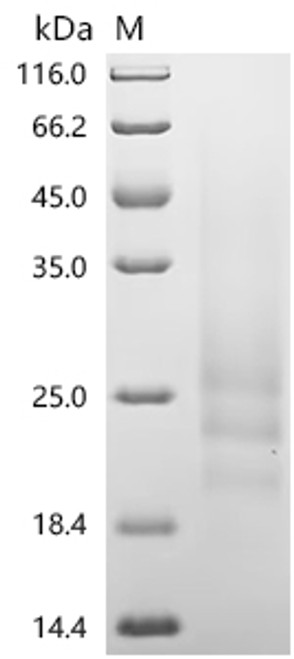 Recombinant Mouse Gastric inhibitory polypeptide receptor(Gipr), partial (CSB-YP009438MO1) Recombinant Mouse Gastric inhibitory polypeptide receptor(Gipr), partial (CSB-YP009438MO1)