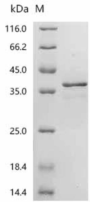 Recombinant Saccharomyces cerevisiae NADPH-dependent methylglyoxal reductase GRE2 (GRE2) (CSB-YP609123SVG)