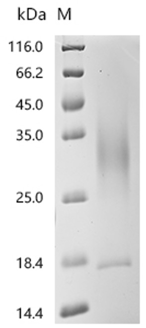 Recombinant Human Cytochrome b5 type B(CYB5B) , partial (CSB-YP006310HU1) Recombinant Human Cytochrome b5 type B(CYB5B) , partial (CSB-YP006310HU1)