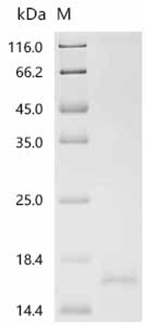 Recombinant Human Serine/threonine-protein kinase receptor R3(ACVRL1), partial (CSB-YP001262HU1) Recombinant Human Serine/threonine-protein kinase receptor R3(ACVRL1), partial (CSB-YP001262HU1)