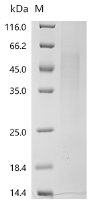 Recombinant Human T-cell differentiation antigen CD6(CD6), partial (CSB-YP326953HU)