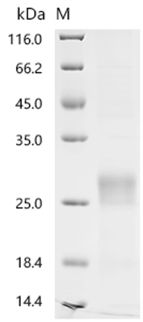 Recombinant Human T-cell surface glycoprotein CD8 alpha chain(CD8A), partial (CSB-YP004966HUf3)