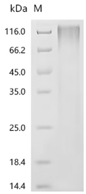 Recombinant Human T-cell differentiation antigen CD6(CD6), partial (CSB-YP326953HUa0) Recombinant Human T-cell differentiation antigen CD6(CD6), partial (CSB-YP326953HUa0)