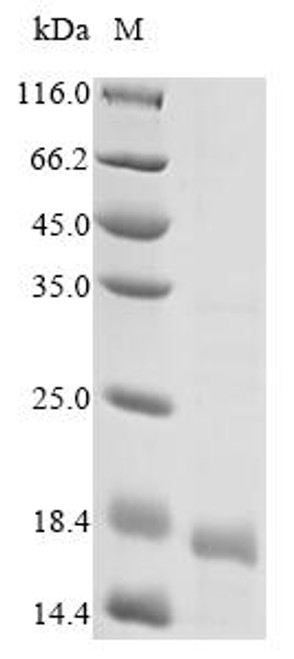 Recombinant Human Interleukin-15 (IL15) (CSB-YP011593HU) Recombinant Human Interleukin-15 (IL15) (CSB-YP011593HU)