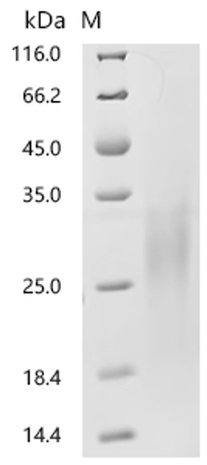 Recombinant Human Mucin-13(MUC13), partial (CSB-YP887973HU1) Recombinant Human Mucin-13(MUC13), partial (CSB-YP887973HU1)